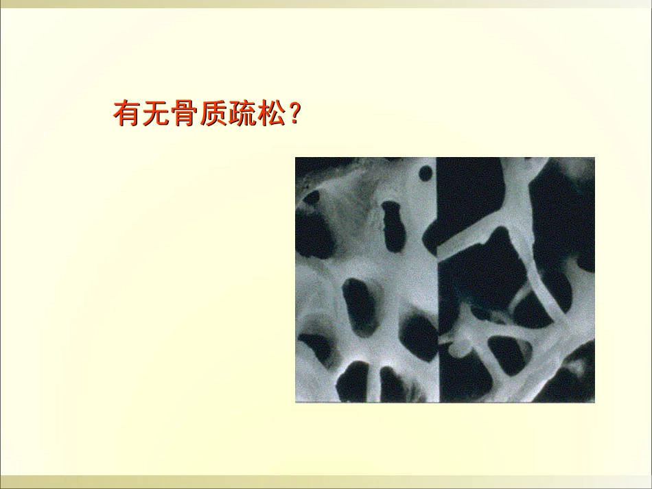 外影像与诊断学：骨科读片基础_第13页