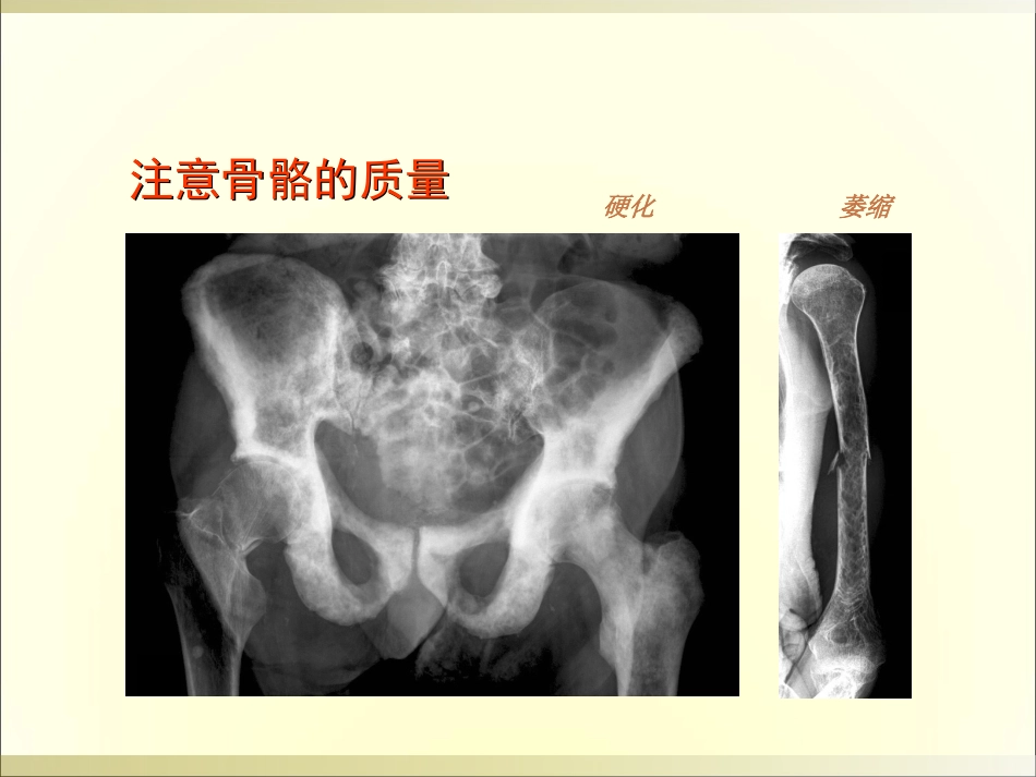 外影像与诊断学：骨科读片基础_第14页