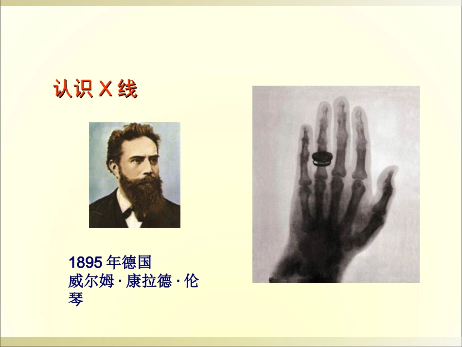 外影像与诊断学：骨科读片基础_第2页