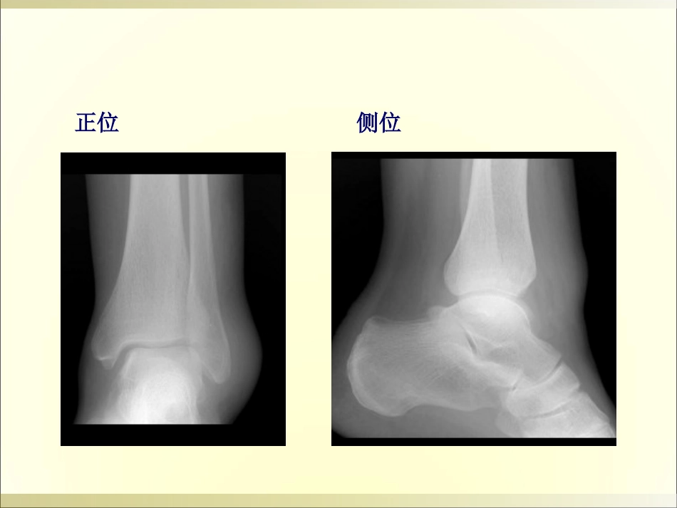 外影像与诊断学：骨科读片基础_第5页
