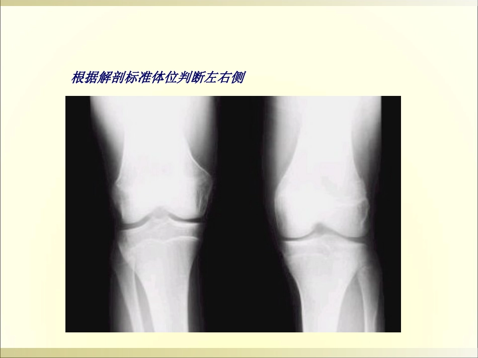 外影像与诊断学：骨科读片基础_第7页
