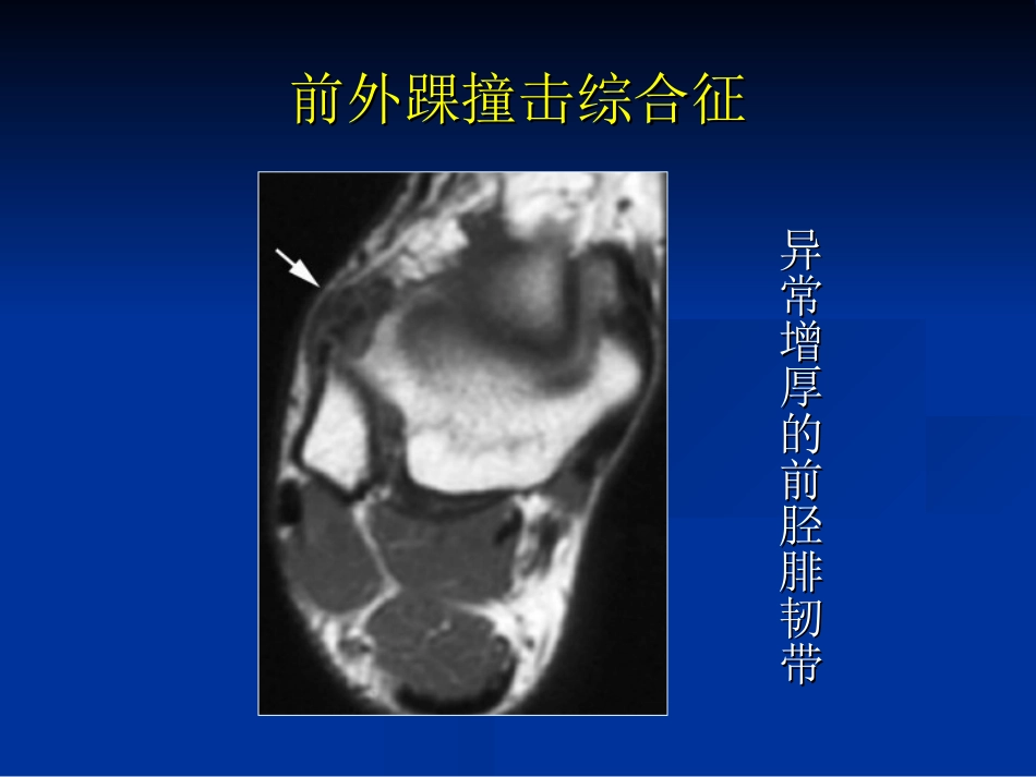 外影像与诊断学：踝关节撞击综合征影像学_第12页