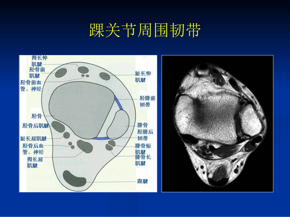 外影像与诊断学：踝关节撞击综合征影像学_第6页