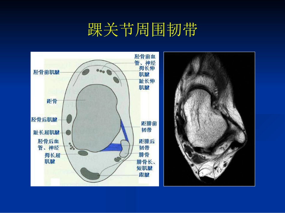 外影像与诊断学：踝关节撞击综合征影像学_第7页