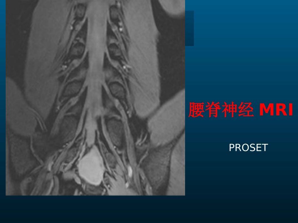 外影像与诊断学：颈椎病的MRI诊断_第11页