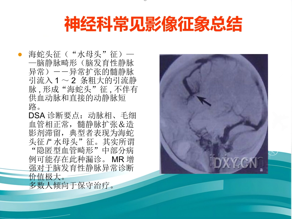 常见神经科影像资料_第9页