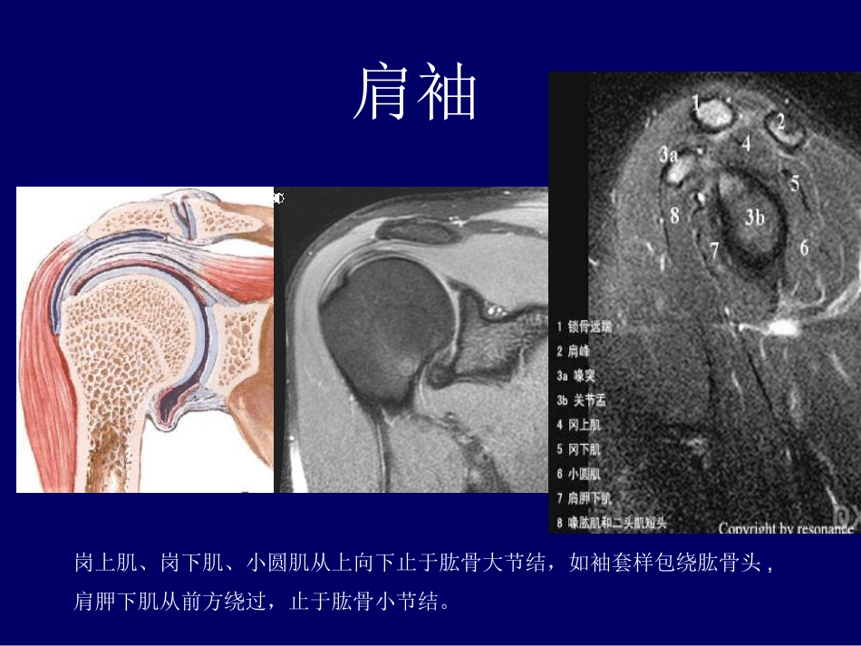 外影像与诊断学：肩关节应用解剖及腱鞘肌腱病的磁共振影像诊断_第3页