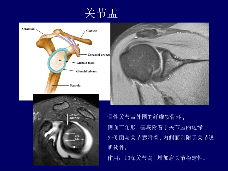 外影像与诊断学：肩关节应用解剖及腱鞘肌腱病的磁共振影像诊断_第5页