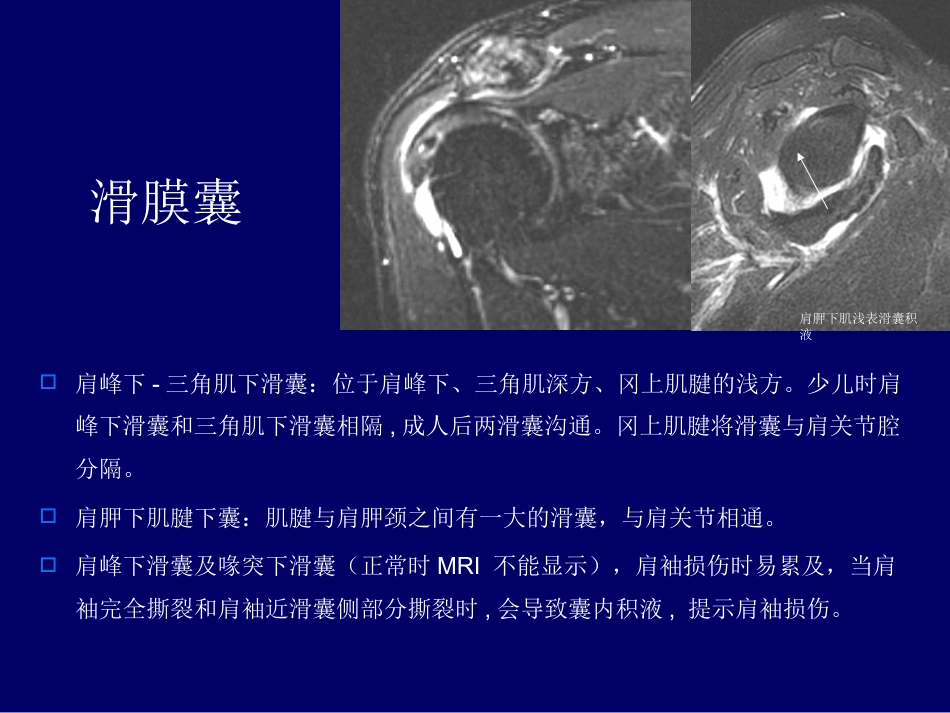 外影像与诊断学：肩关节应用解剖及腱鞘肌腱病的磁共振影像诊断_第8页