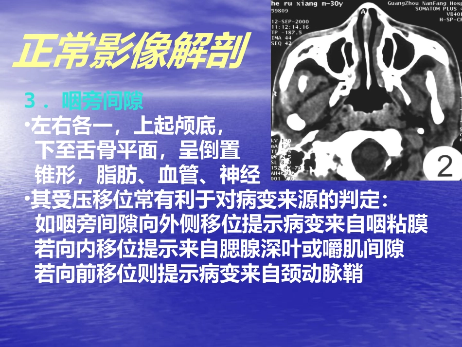 鼻咽癌的影像诊断_第10页