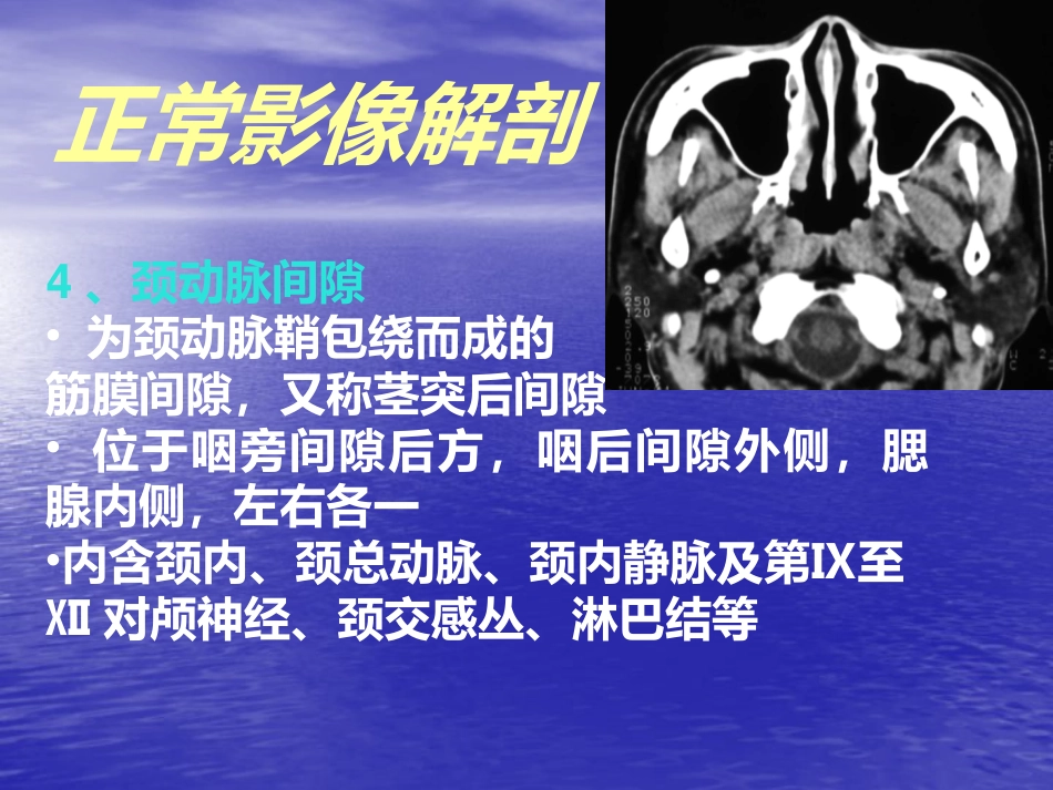鼻咽癌的影像诊断_第11页