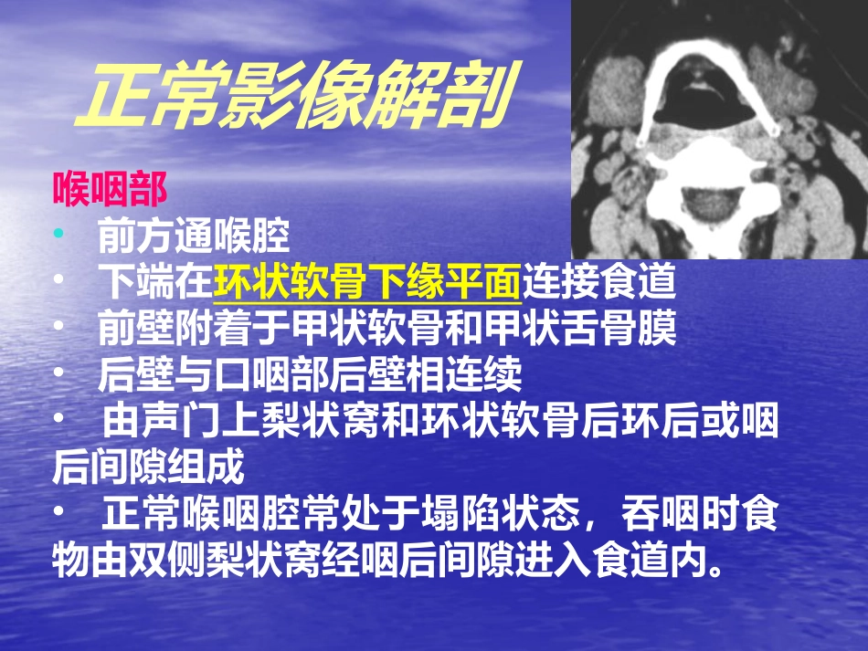 鼻咽癌的影像诊断_第13页