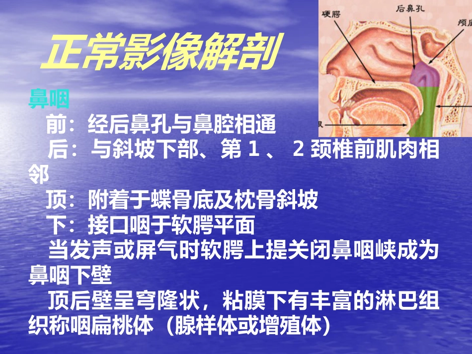 鼻咽癌的影像诊断_第4页