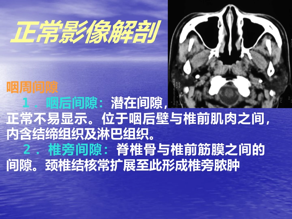 鼻咽癌的影像诊断_第9页