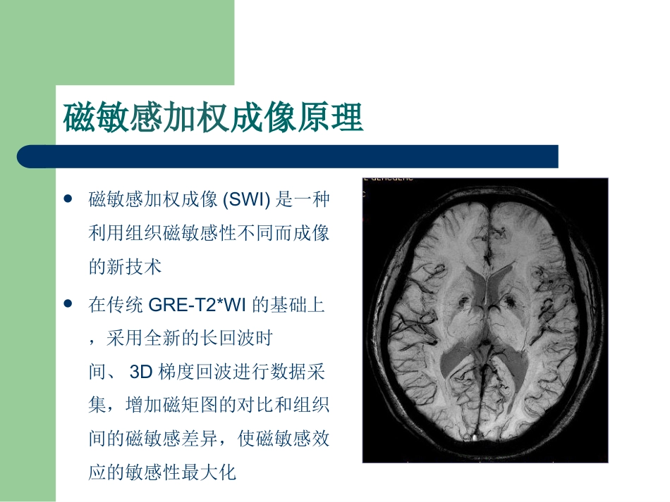 磁敏感加权成像在中枢神经系统的应用_第2页