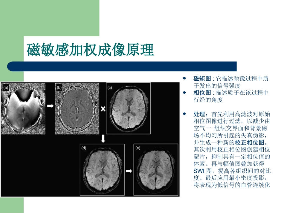 磁敏感加权成像在中枢神经系统的应用_第3页