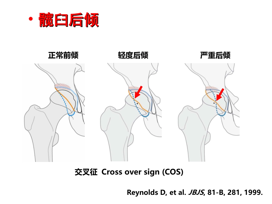 外影像与诊断学：成人髋关节影像学_第15页