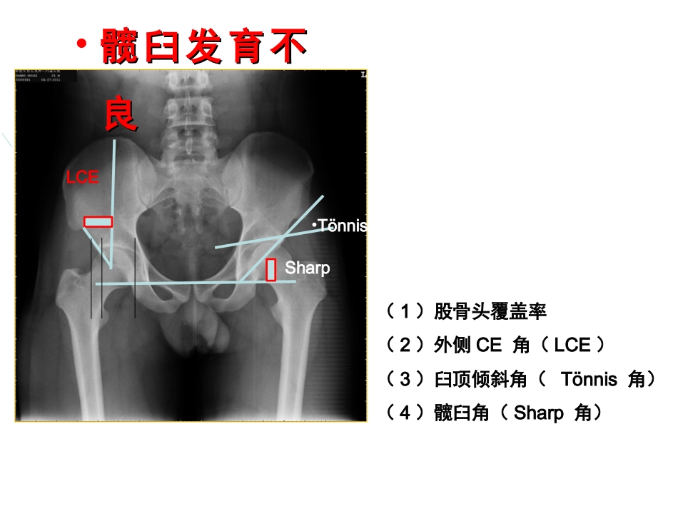 外影像与诊断学：成人髋关节影像学_第6页