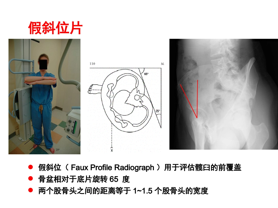 外影像与诊断学：成人髋关节影像学_第7页