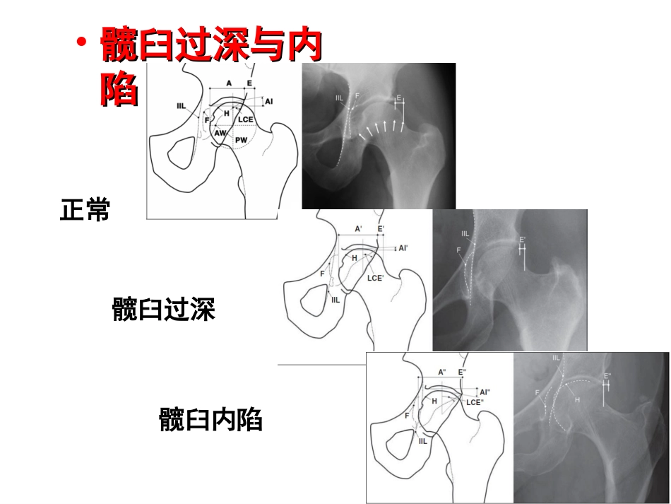 外影像与诊断学：成人髋关节影像学_第9页