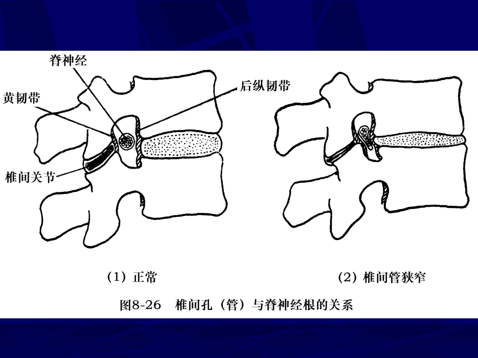 外影像与诊断学：腰椎影像解剖及常见病变_第13页