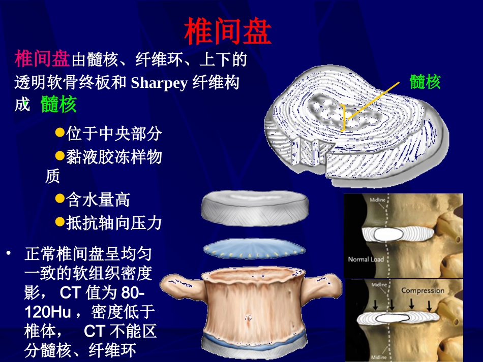 外影像与诊断学：腰椎影像解剖及常见病变_第3页