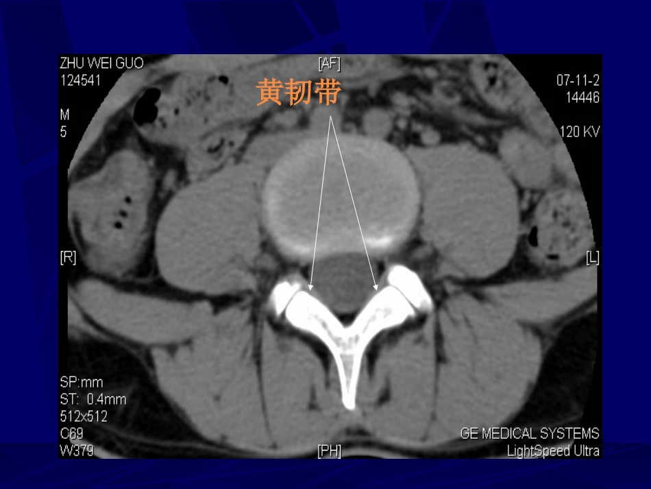 外影像与诊断学：腰椎影像解剖及常见病变_第7页