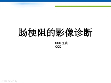 肠梗阻的影像诊断肠梗阻的影像分析