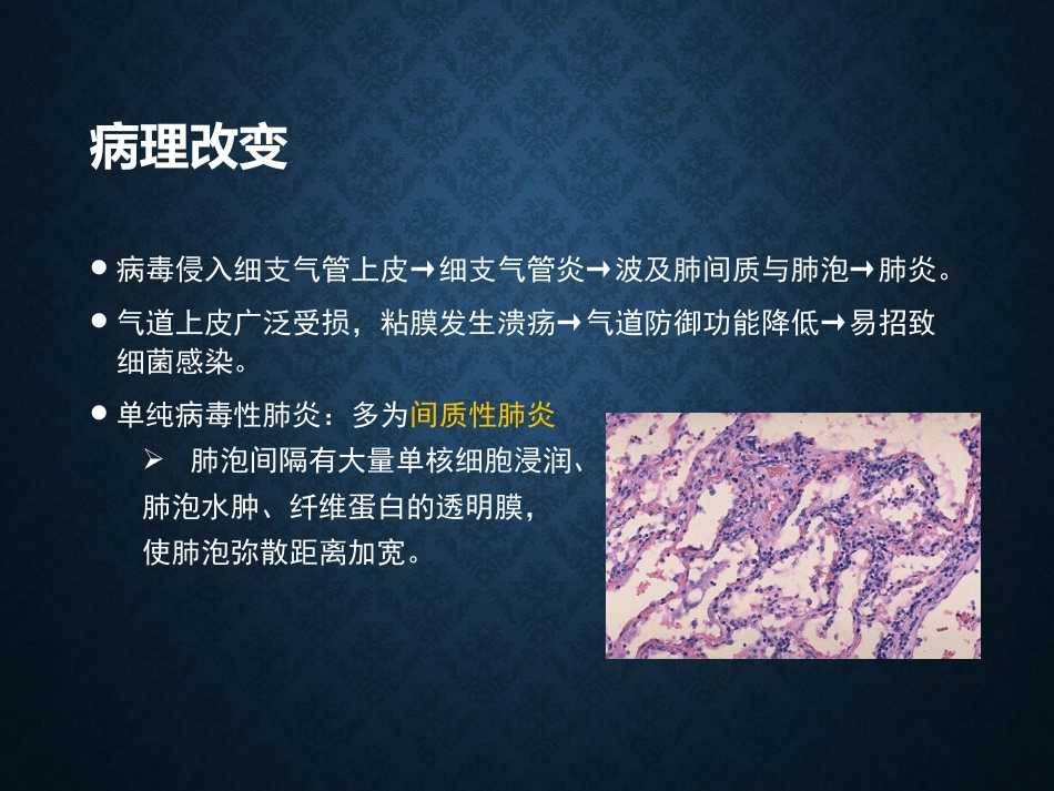 病毒性肺炎影像_第4页