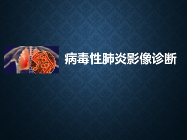 病毒性肺炎影像