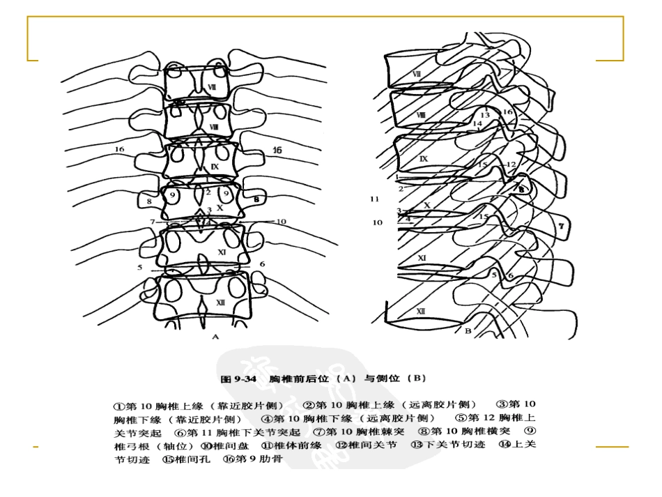 外影像与诊断学：脊柱x片诊断_第10页