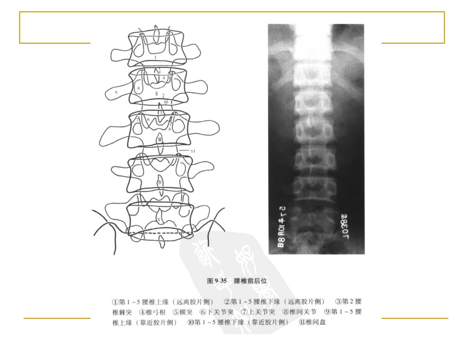 外影像与诊断学：脊柱x片诊断_第11页