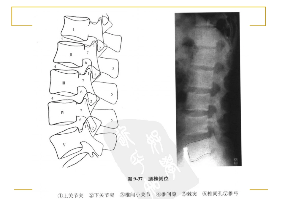 外影像与诊断学：脊柱x片诊断_第12页