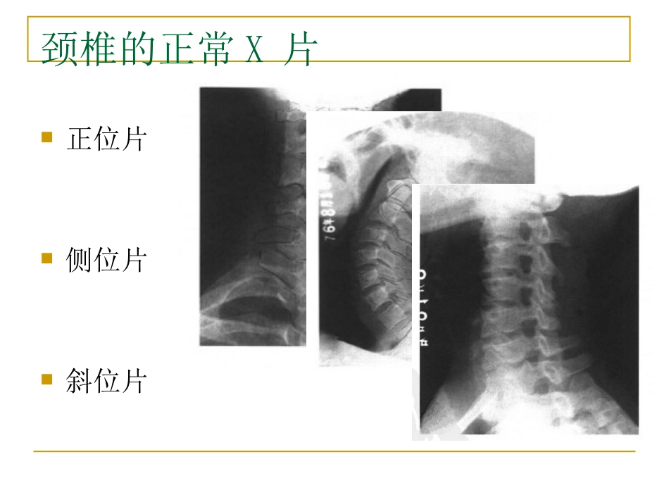 外影像与诊断学：脊柱x片诊断_第3页