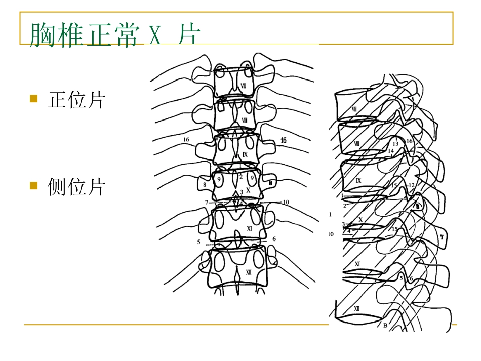 外影像与诊断学：脊柱x片诊断_第4页