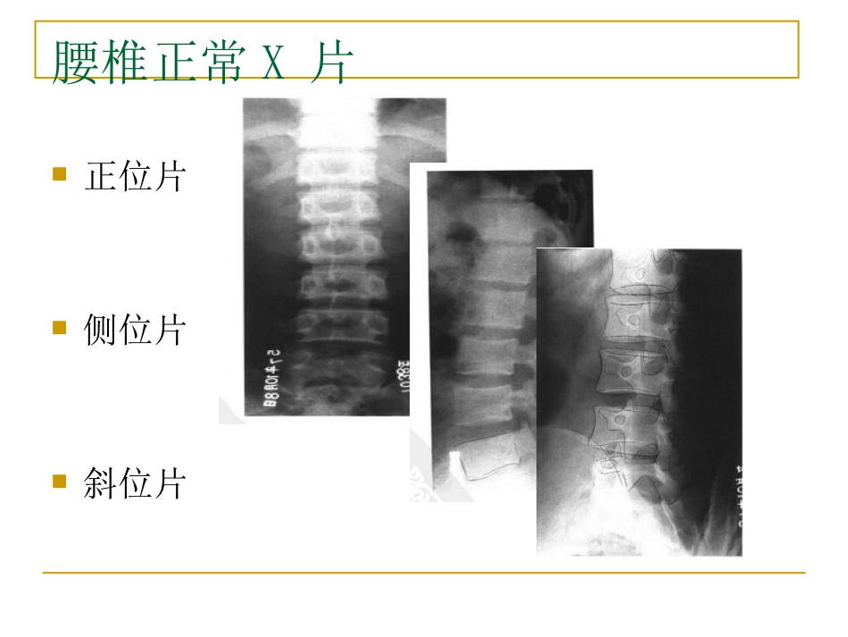 外影像与诊断学：脊柱x片诊断_第5页