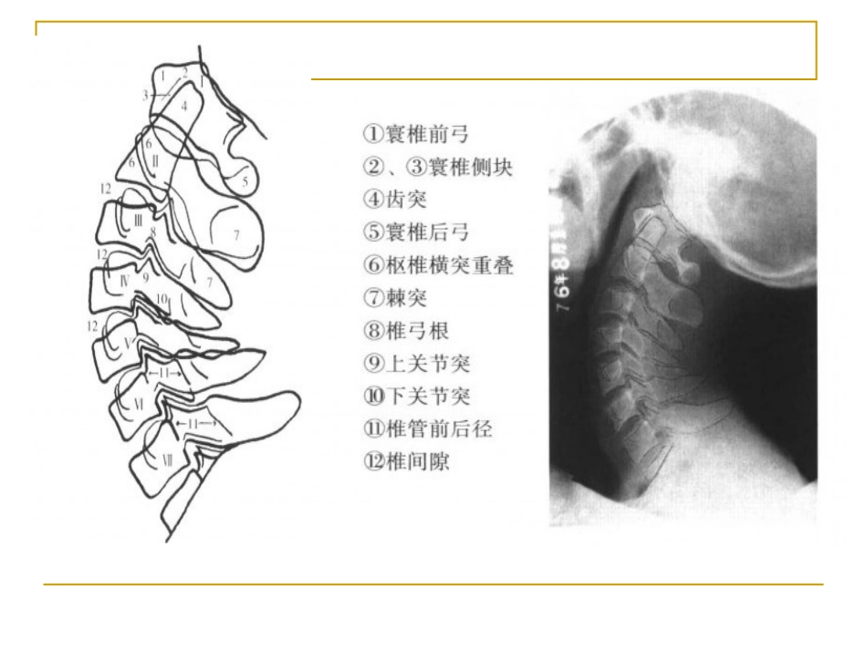 外影像与诊断学：脊柱x片诊断_第7页