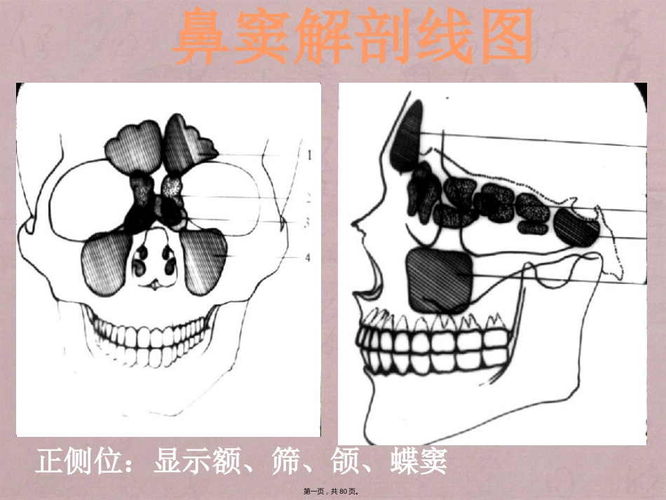 鼻窦影像诊断_第1页