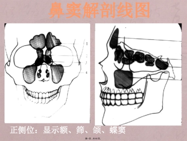 鼻窦影像诊断
