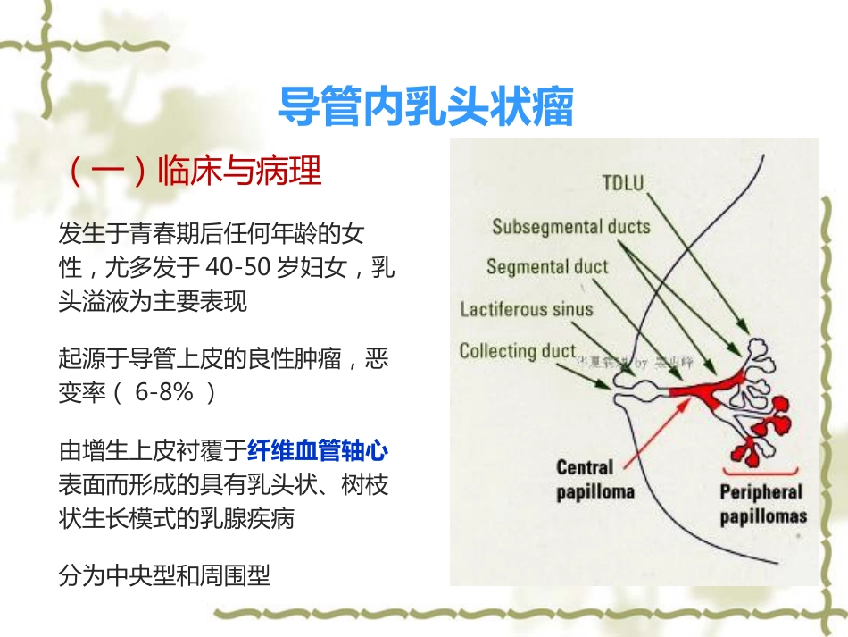 常见乳腺肿瘤的影像表现_第10页