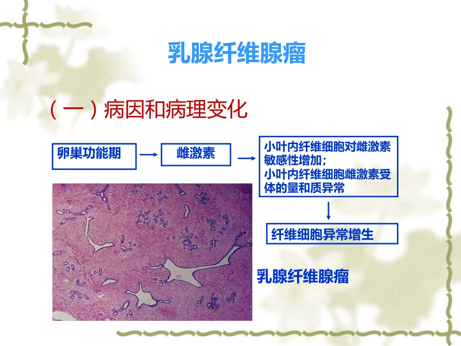 常见乳腺肿瘤的影像表现_第3页