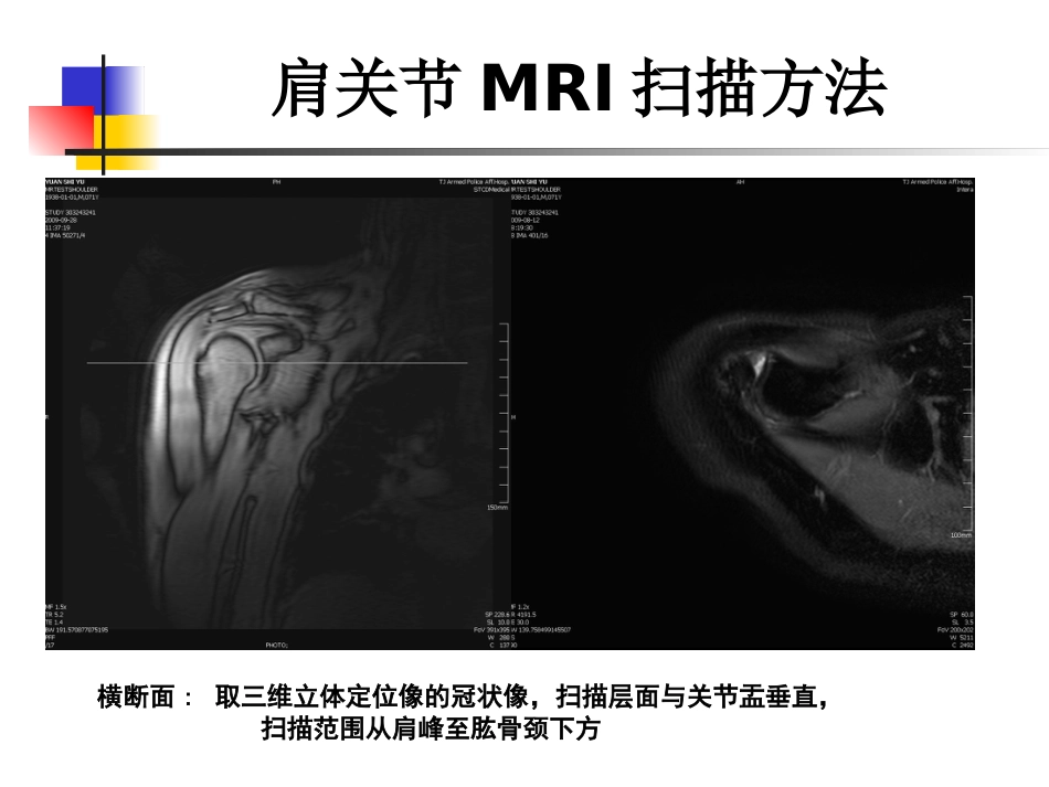 外影像与诊断学：肩关节病变MRI解剖和诊断_第5页