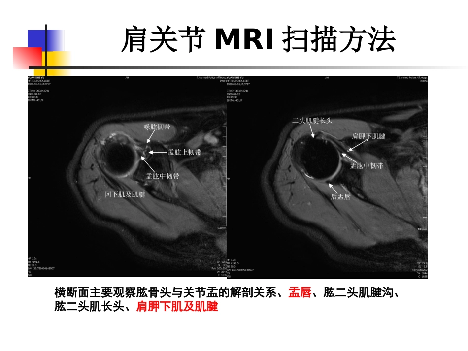 外影像与诊断学：肩关节病变MRI解剖和诊断_第6页