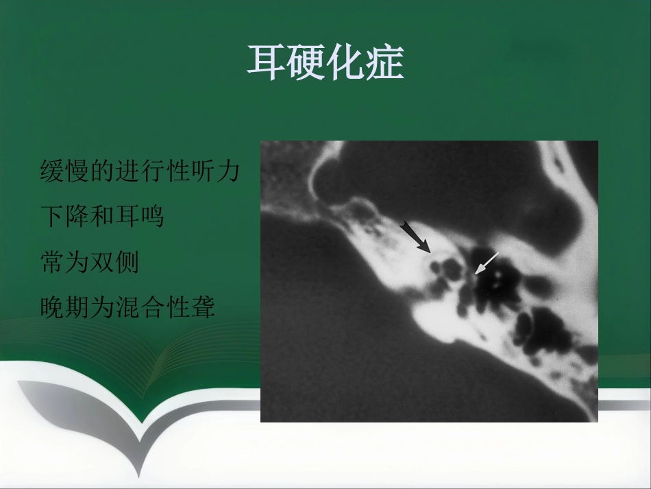 常见耳科症状影像学检查路径与分析思路_第12页
