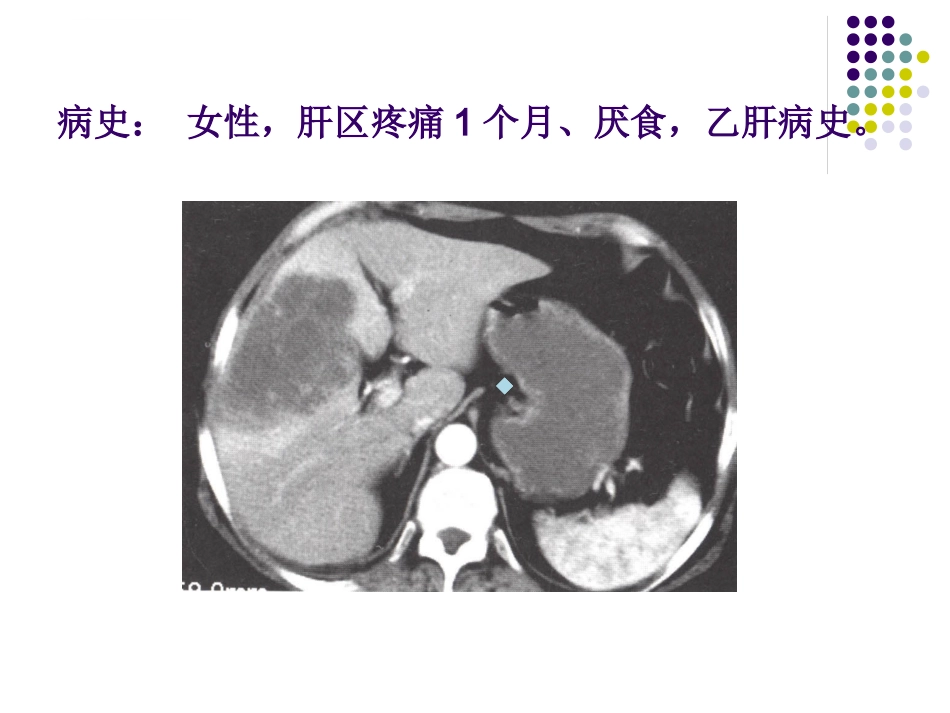 CT影像的识别_第11页