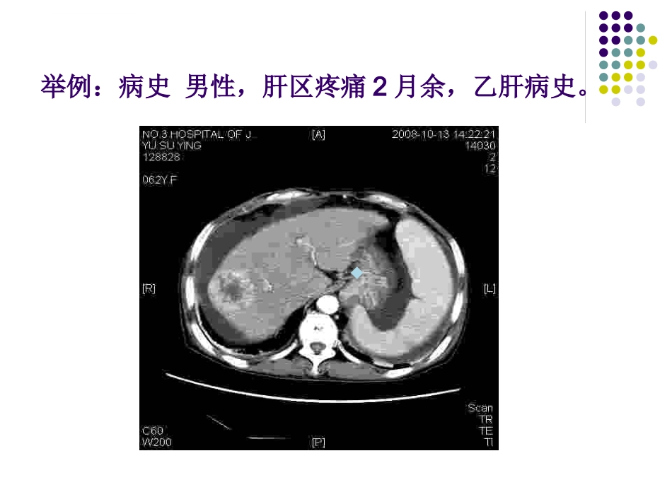 CT影像的识别_第12页