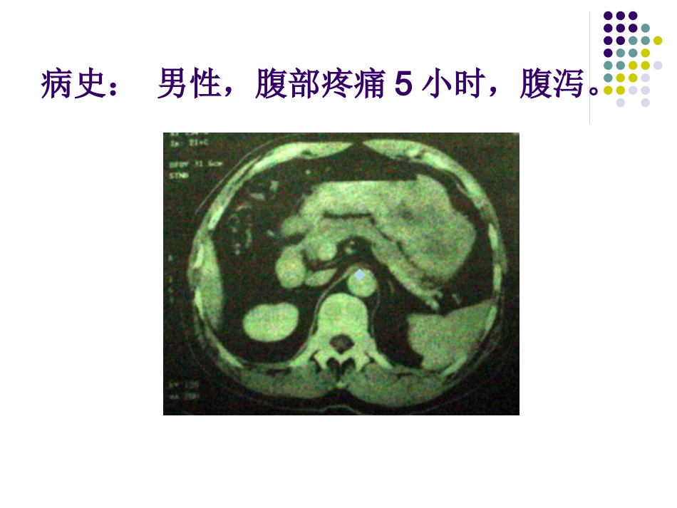 CT影像的识别_第14页