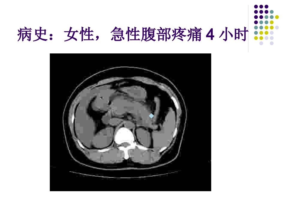 CT影像的识别_第15页