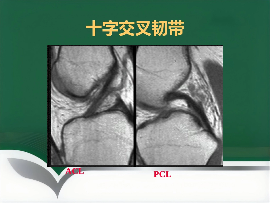 常见骨关节疾病MRI影像学表现_第11页
