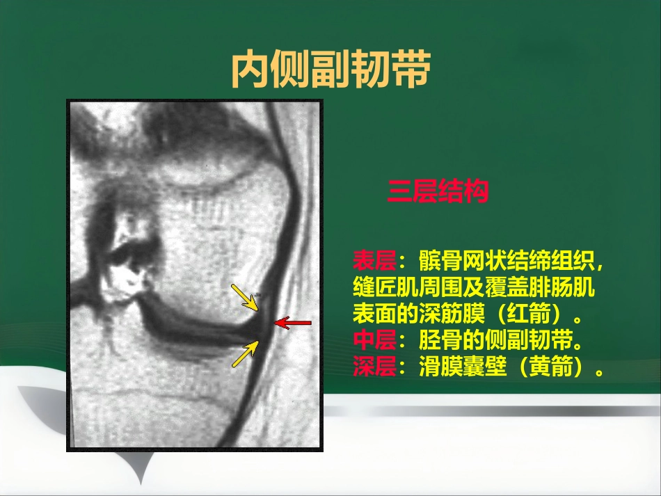 常见骨关节疾病MRI影像学表现_第12页